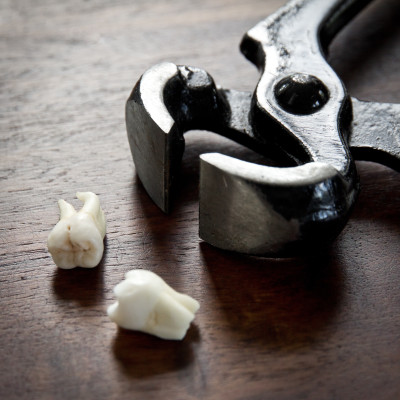 Kristin Holt | Old West Dentistry. Image: heavy metal plyers on wooden surface, with two human molars.