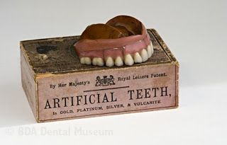 Kristin Holt | Late Victorian Dentistry: Ultra Modern! Photgraph of Vulcanite (rubber) dentures, 1850.