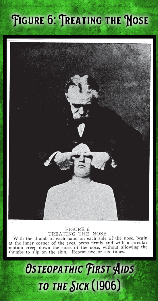 Kristin Holt | Victorian-American Headaches: Part 7. Figure 6 from Osteopathic First Aids to the Sick (1906). Treating the Nose, one step of the headache treatment.